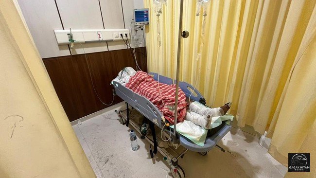 Ledakan Hebat di SPPG Mojokerto Puri Medali, Atap Runtuh dan Picu Kebakaran, 5 Orang Terluka